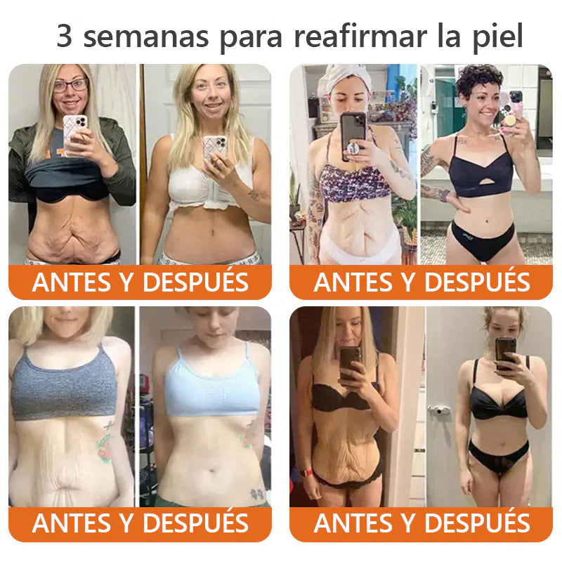 Awzlove™ Suero reafirmante en barra con veneno de abeja y botox (🇲🇽AMEDE recomienda)💄