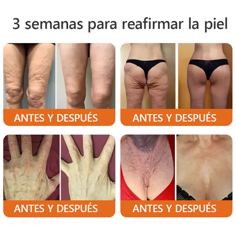 Awzlove™ Suero reafirmante en barra con veneno de abeja y botox (🇲🇽AMEDE recomienda)💄