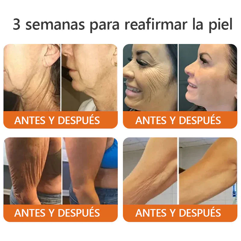 Awzlove™ Suero reafirmante en barra con veneno de abeja y botox (🇲🇽AMEDE recomienda)💄