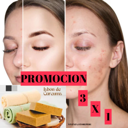Jabón de Cúrcuma Pack x3